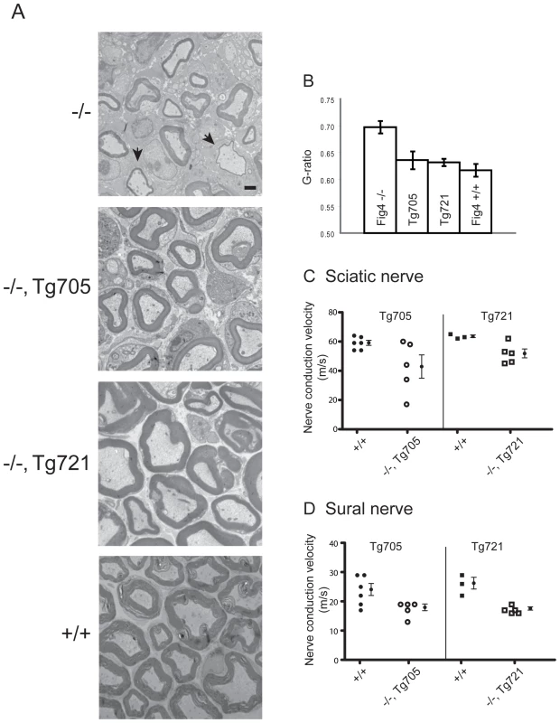 Rescue of peripheral nerve myelination and nerve conduction velocity in transgenic Tg705 and Tg721 lines.