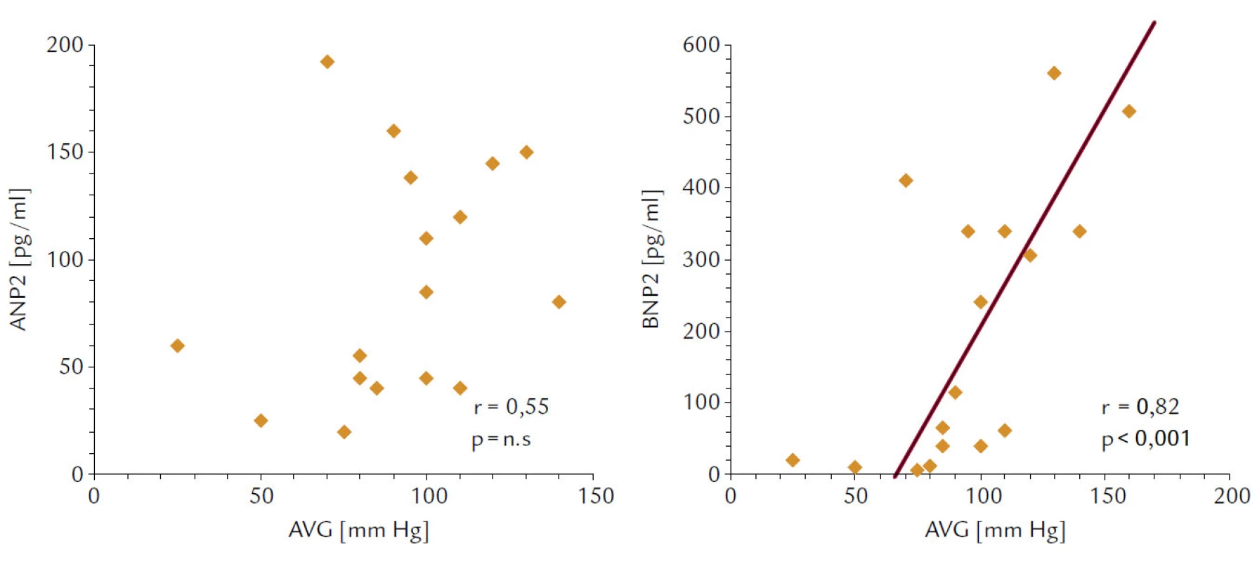 Korelácie medzi vrcholovým aortovým gradientom (AVG) a koncentráciami ANP 2 a BNP 2 (ihneď po ukončení 6-minútového testu chôdzou).