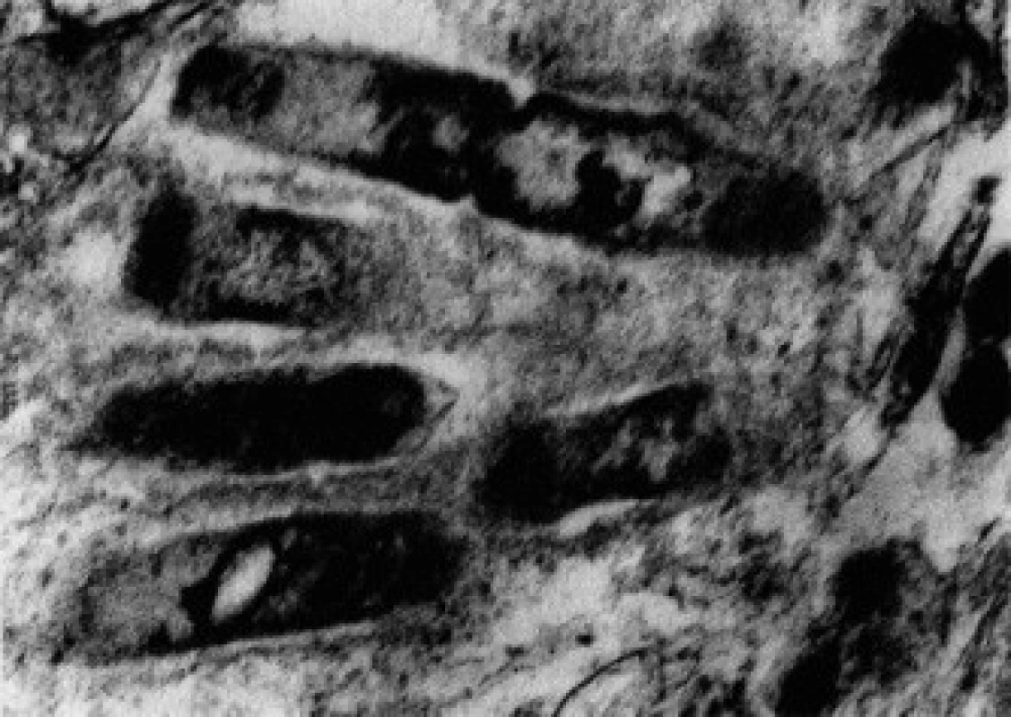 Bakterie přítomné v cytoplazmě makrofágu mají vzhled tyčinek s dvojitě konturovanou stěnou.
