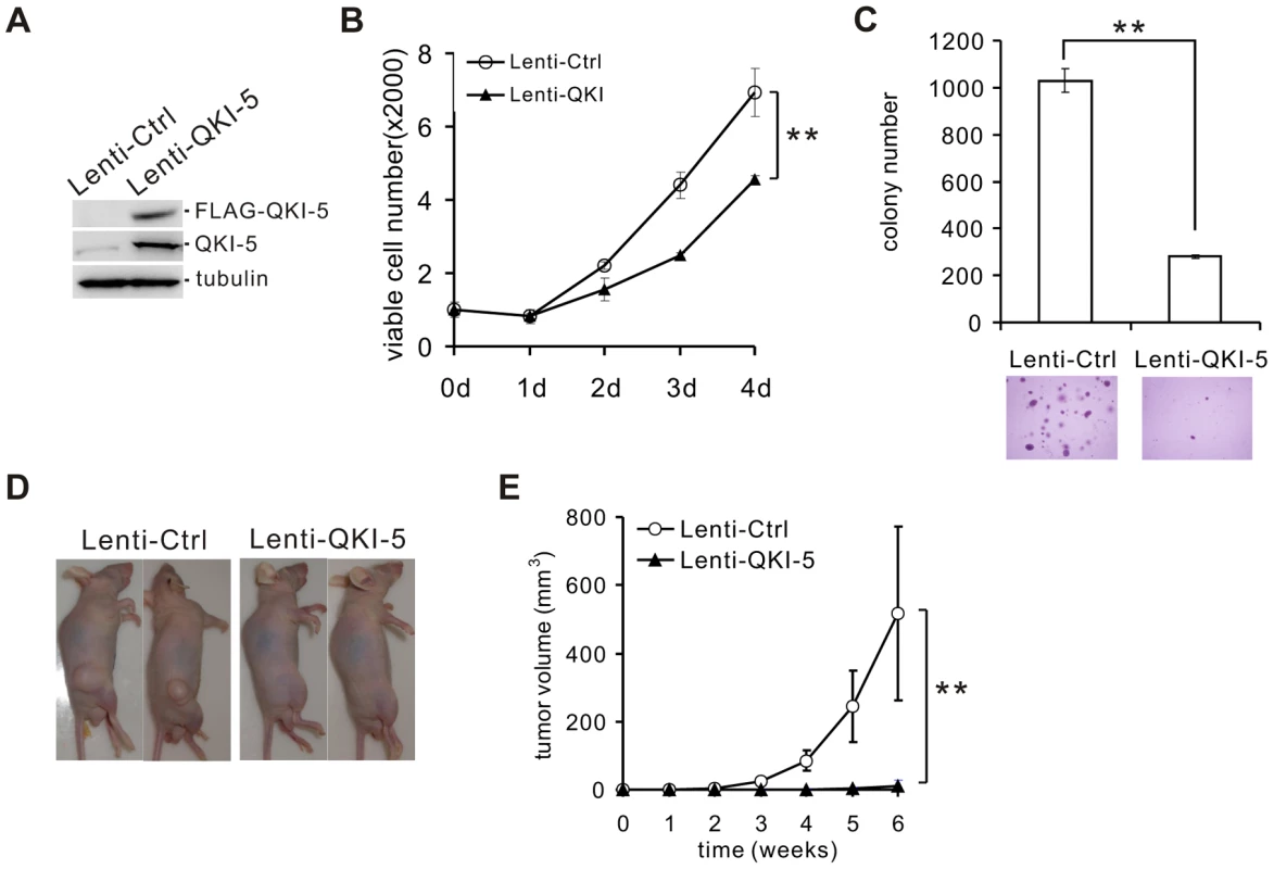QKI-5 inhibits lung cancer cell proliferation and transformation.