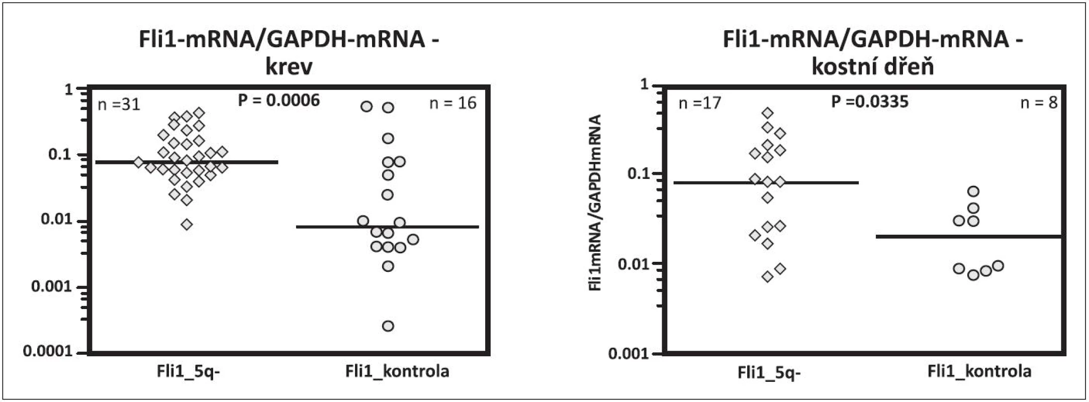 Fli1 mRNA v krvi a v kostní dřeni u pacientů s 5q- syndromem a u zdravých kontrol srovnatelného věku.