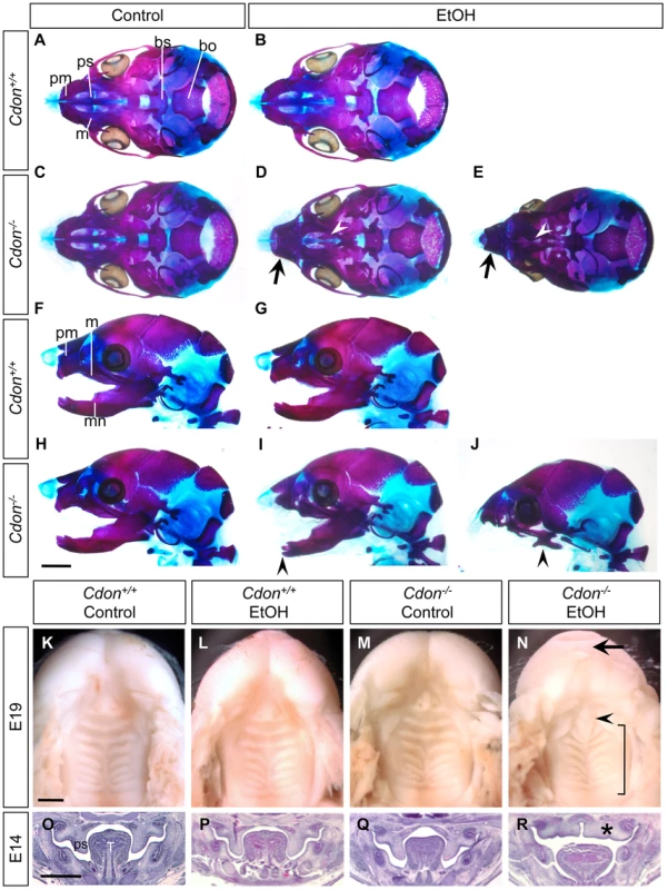 Cranial bone and palatogenesis defects in ethanol-treated <i>Cdon<sup>−/−</sup></i> mice.