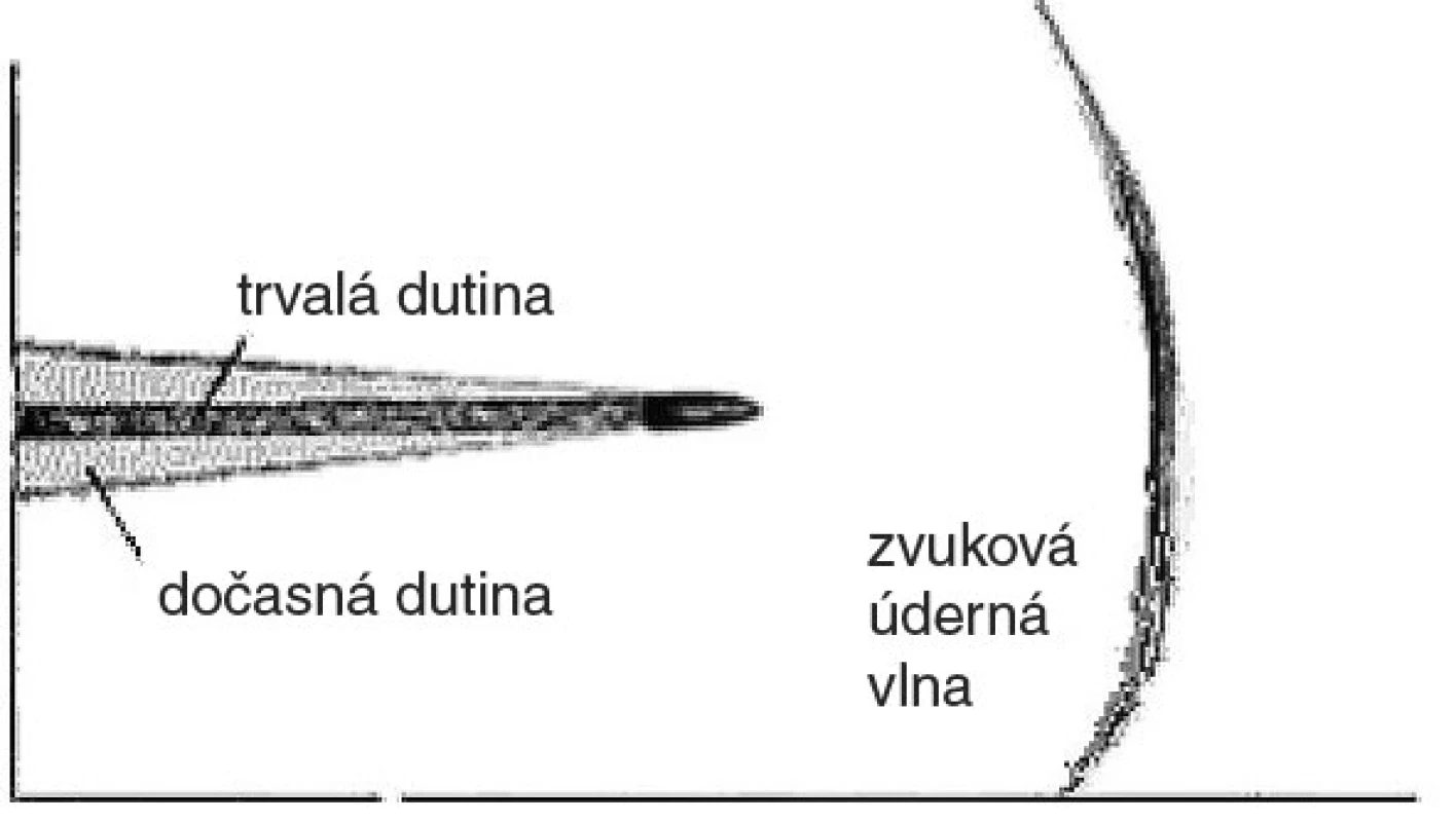Mechanismus vzniku střelného poranění a formování dočasné a trvalé dutiny
Fig. 1. Gunshot wound mechanism and forming of temporary and permanent cavity