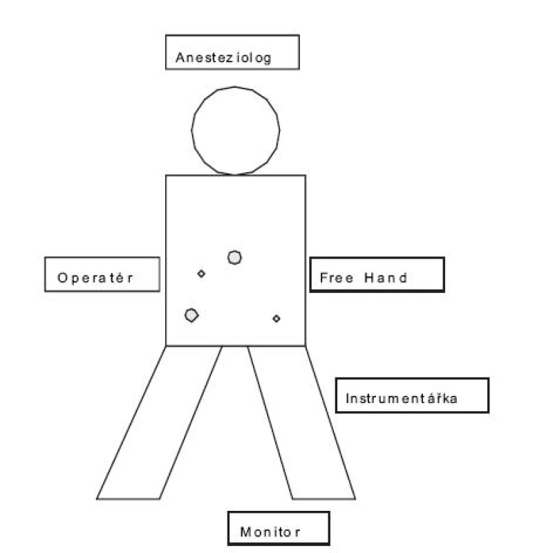 Schéma pozice pacienta, týmu a nástrojů u resekce kolon sigmoideum
Pic. 1. The schema of position of patients, the operating team, and the instruments in resection of sigmoid colon