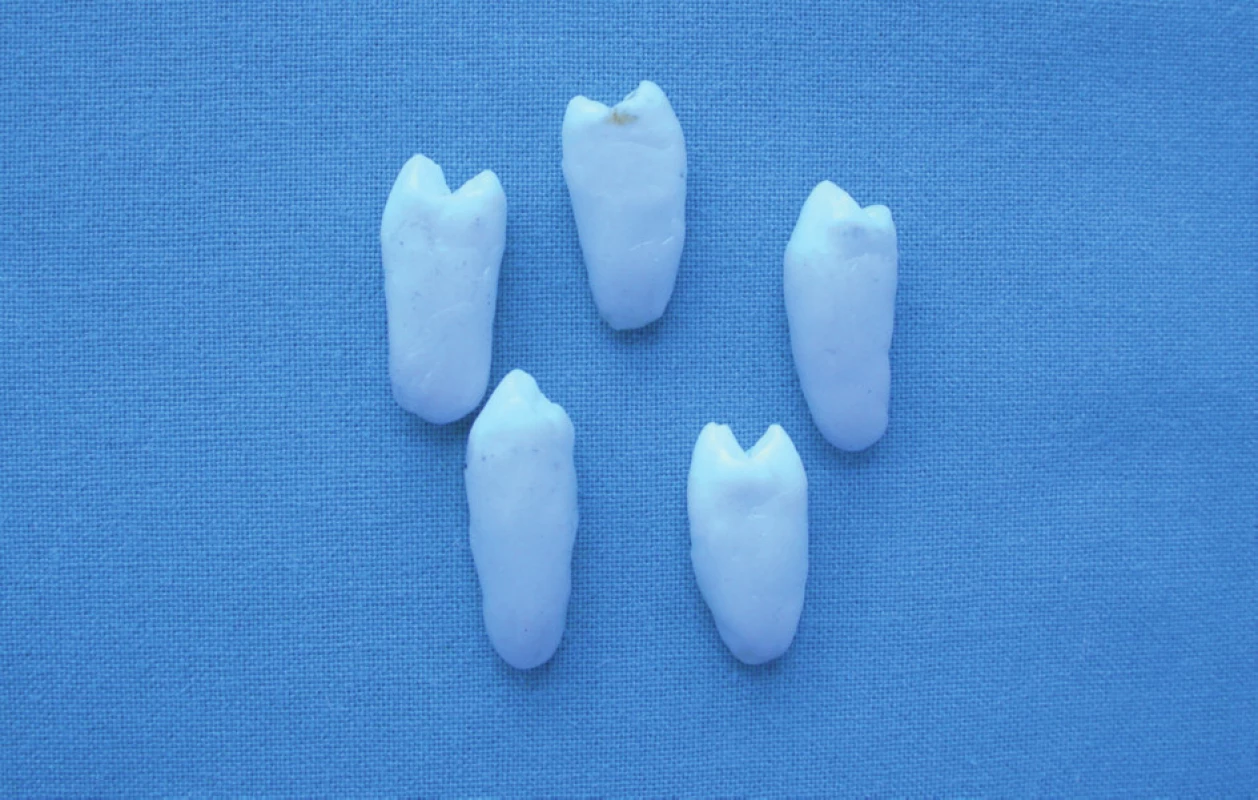Úprava zubů skupiny C.