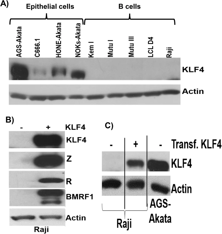 KLF4 is not expressed in B cells but can reactivate lytic EBV gene expression in this cell type.