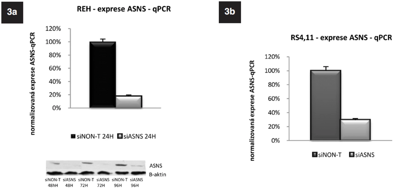 Exprese genu pro ASNS u linie REH a RS4;11 po specifickém umlčení tohoto genu metodou RNA-interference. Western Blot potvrzující úspěšnost umlčení genu pro ASNS na proteinové úrovni u linie REH.