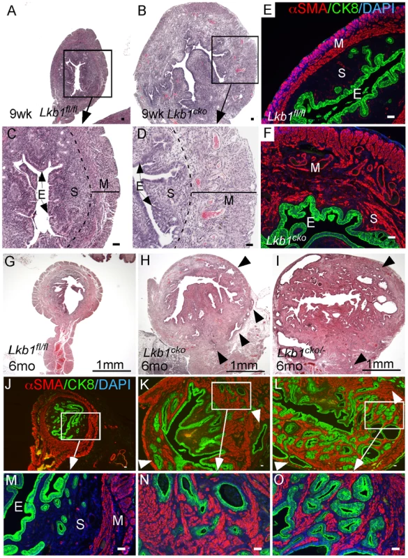 Loss of LKB1 in mesenchymal cells induces endometrial cancer.