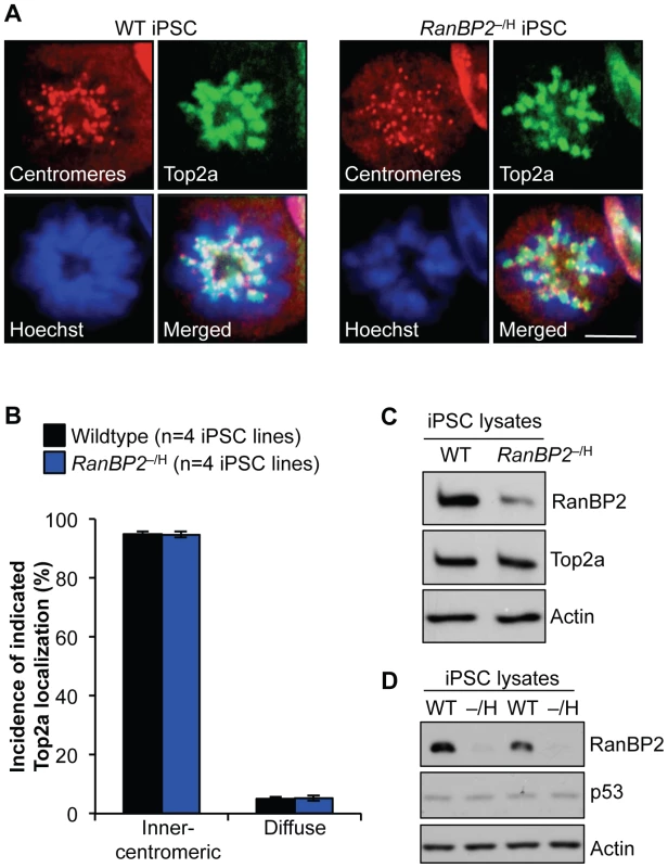 <i>RanBP2</i><sup>–/H</sup> iPSCs efficiently recruit Top2a to the inner centromeres.