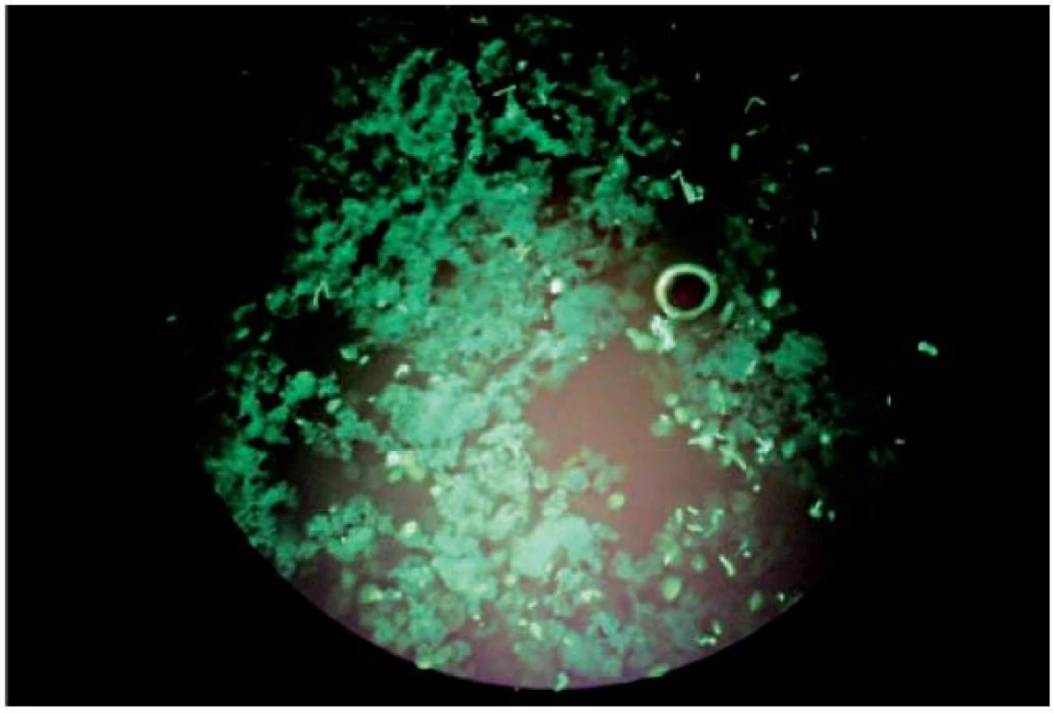 Vlákna a spóry malasezií ve fluorescenčním preparátu (barvení Rylux BS, zvětšení 400krát)