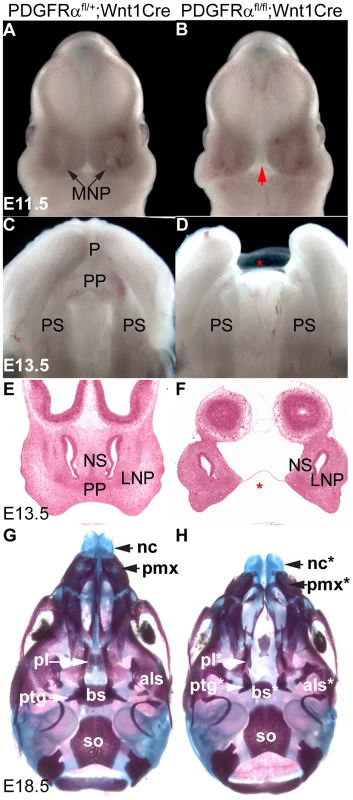 Tissue specific inactivation of PDGFRα from NCCs causes facial clefting and absence of MNP derived structures.
