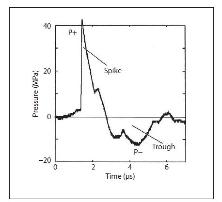 Rozložení fází rázové vlny (převzato z Wein A, Kavoussi L, et al. Campbell-Walsh Urology, 9&lt;sup&gt;th&lt;/sup&gt; ed. Philadelphia: Saunders 2007)
Fig. 2. Phases of shock wave