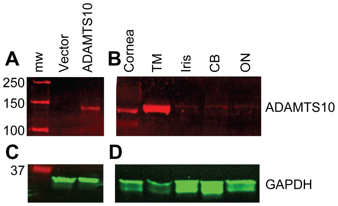 ADAMTS10 protein is highly expressed in the trabecular meshwork.