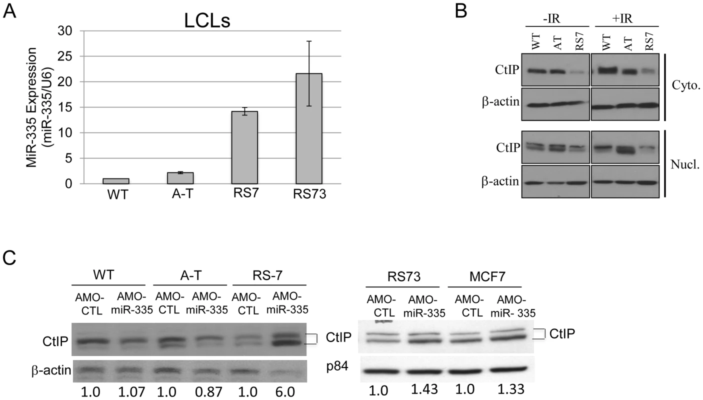 MiR-335 was constitutively overexpressed in RS7 and RS73 LCLs.