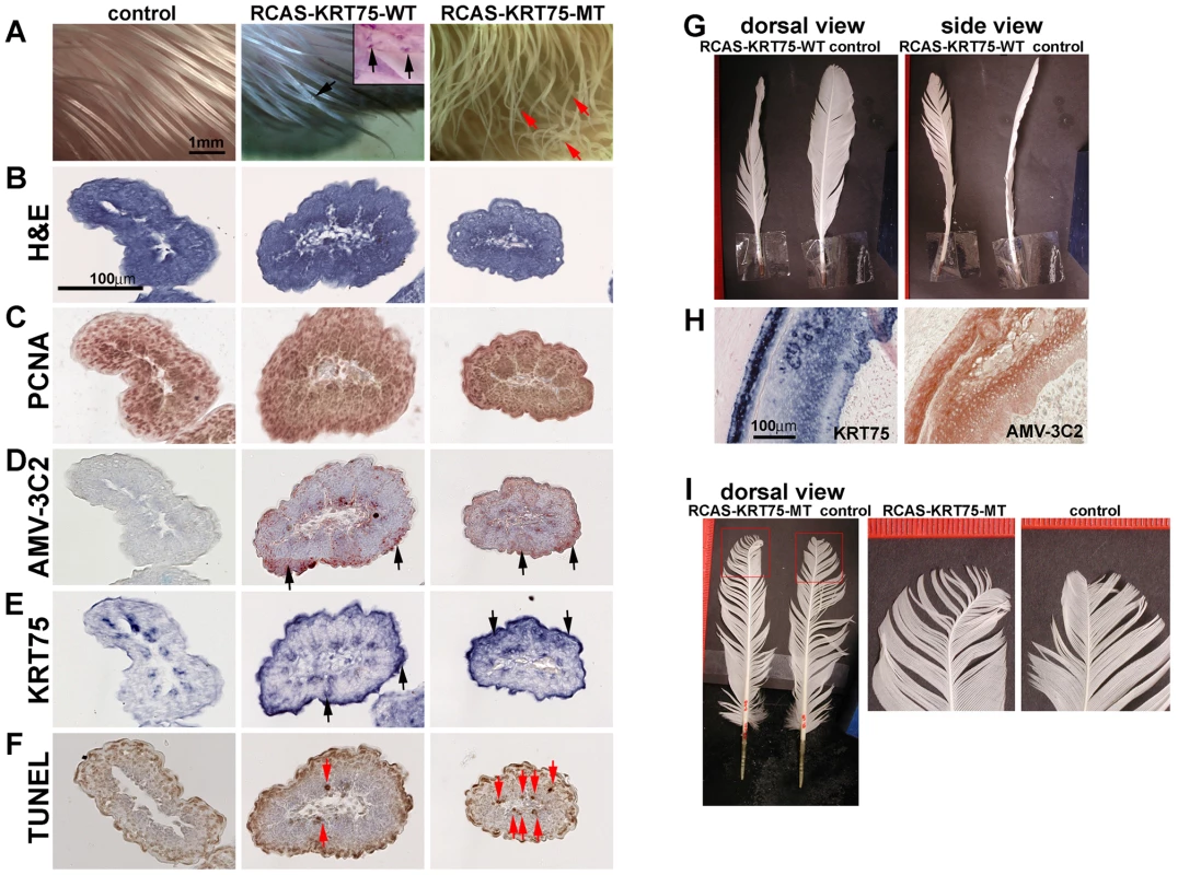 Misexpression of KRT75-WT and KRT75-MT in embryonic and adult feathers.