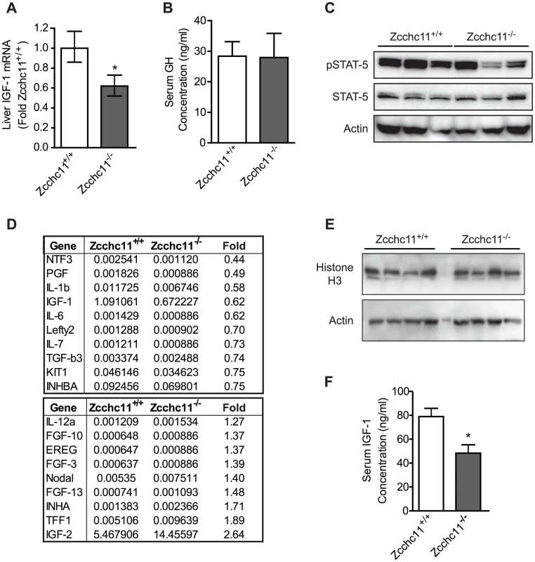 Zcchc11 deficiency decreases IGF-1 expression <i>in vivo</i>.
