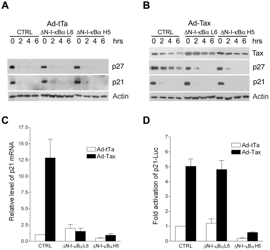 Inhibition of NF-κB prevents the stabilization of p27 protein and the up-regulation of p21 mRNA, but not the trans-activation of p21 promoter by Tax.