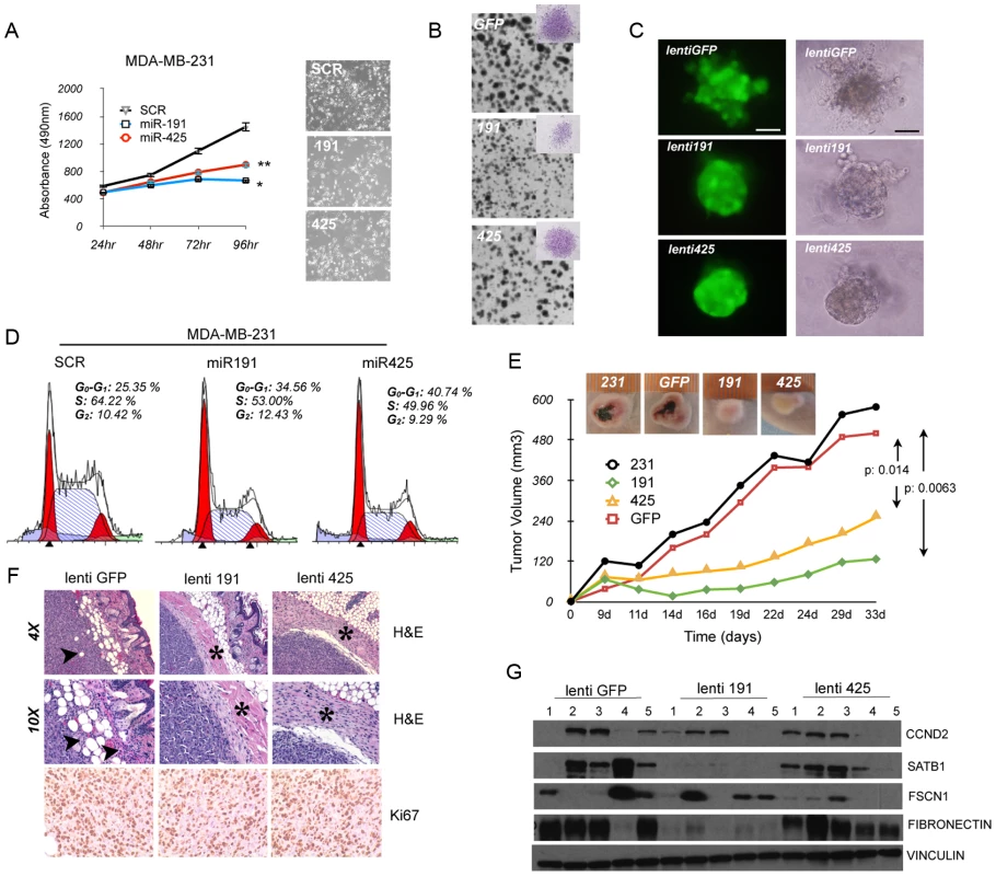 miR-191/425 cluster impairs tumorigenicity of aggressive breast cancer cells.