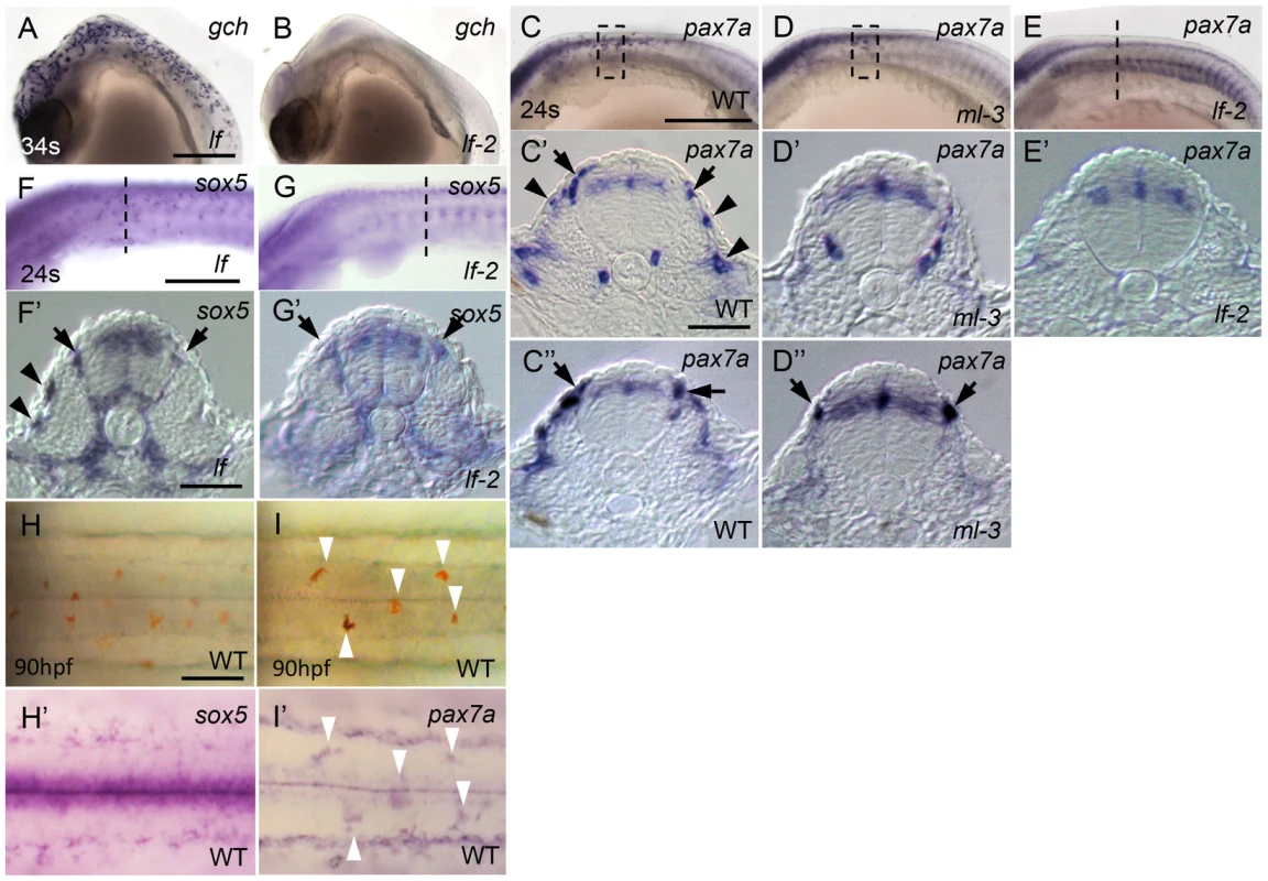 Dual expression of <i>sox5</i> and <i>pax7a</i> is required for xanthophore development.