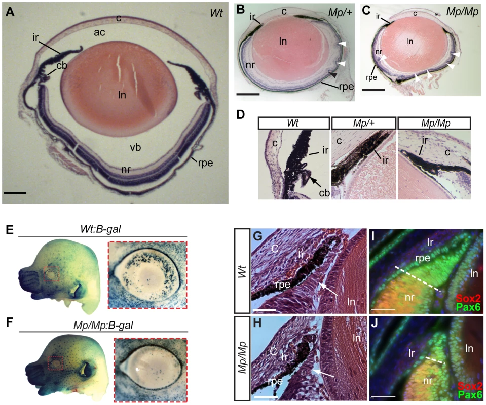 <i>Mp</i> eyes displayed structural defects and abnormal ciliary development.