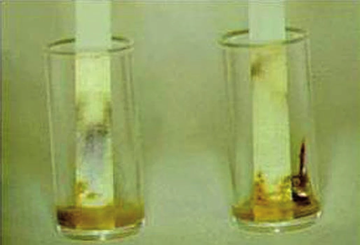Vyšetřování albuminu ve smolce pomocí fenolftaleinové modři.