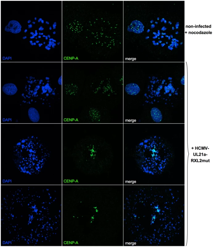 Generalized chromosome shattering in HCMV-UL21a-RXL2mut-infected cells.