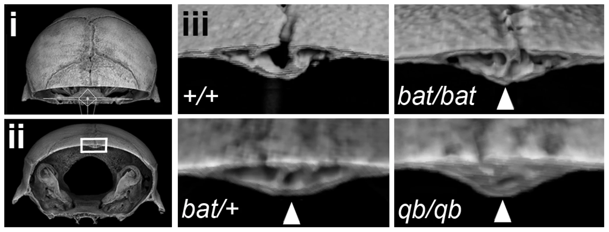 <i>Frem1<sup>bat</sup></i> and <i>Frem1<sup>Qbrick</sup></i> mice exhibit advanced posterior frontal suture fusion.
