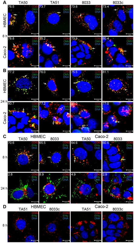 Colocalization of OMVs and EHEC-Hly with endo-lysosomal compartments detected with anti-CD63 antibody.