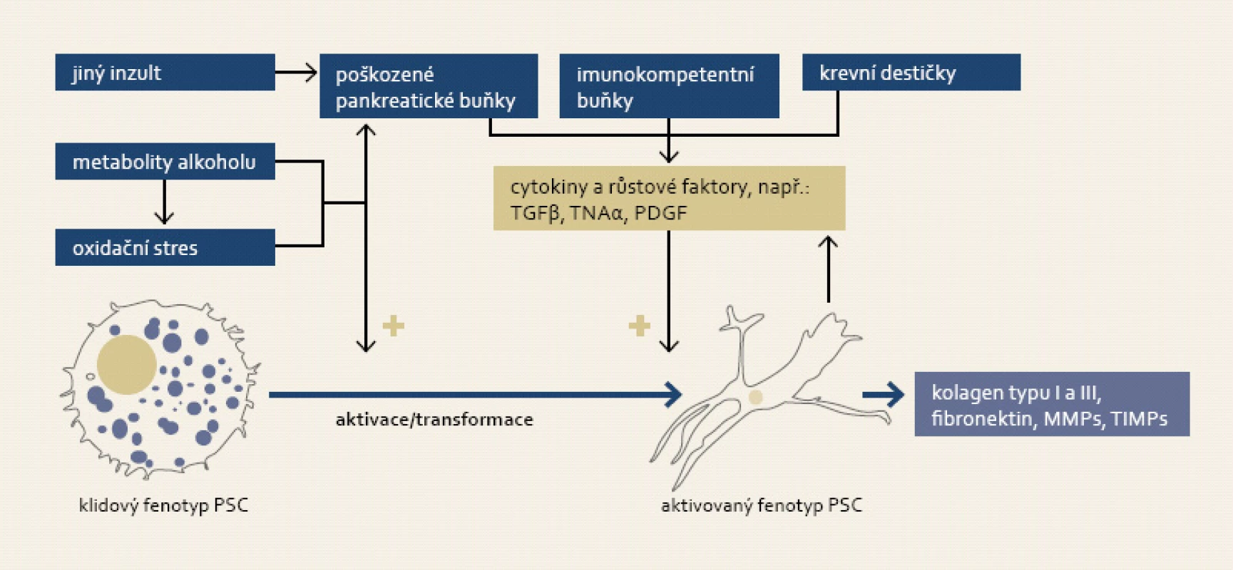 K aktivaci pankreatických stelárních buněk (PSC) dochází jak přímým vlivem metabolitů alkoholu a jimi indukovaným oxidačním stresem, tak i působením cytokinů a růstových faktorů emitovanými imunokompetentními buňkami a stromálními buňkami pankreatu při zánětu. Proces aktivace je morfologicky charakteristický změnou tvaru buňky a ztrátou tukových kapének.
Fig. 4. Activation of pancreatic stellate cells (PSC) is triggered either by alcohol metabolites and subsequent oxidative stress, or by action of cytokines and growth factors secreted by immunocompetent and stromal pancreatic cells accompanying inflammation. Activation of PSC is accompanied by its morphological change and loss of fat droplets.