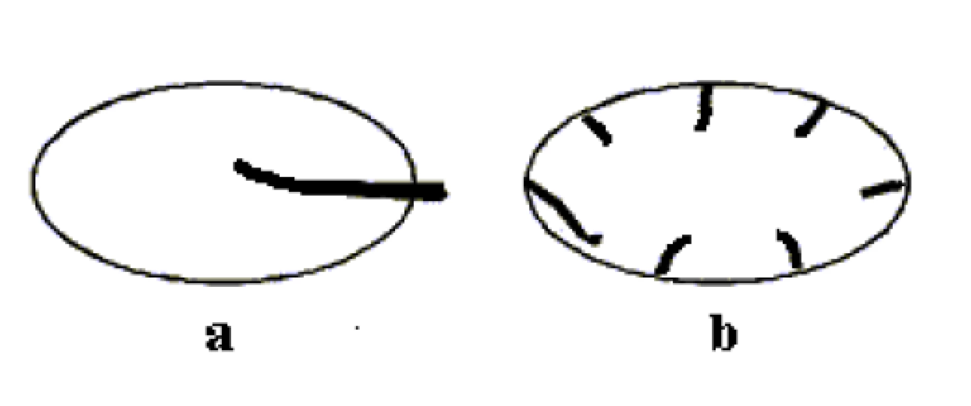 Schéma dvou základních typů prokrvení uzlin: a - hilový (centrální) typ, b - periferní typ.