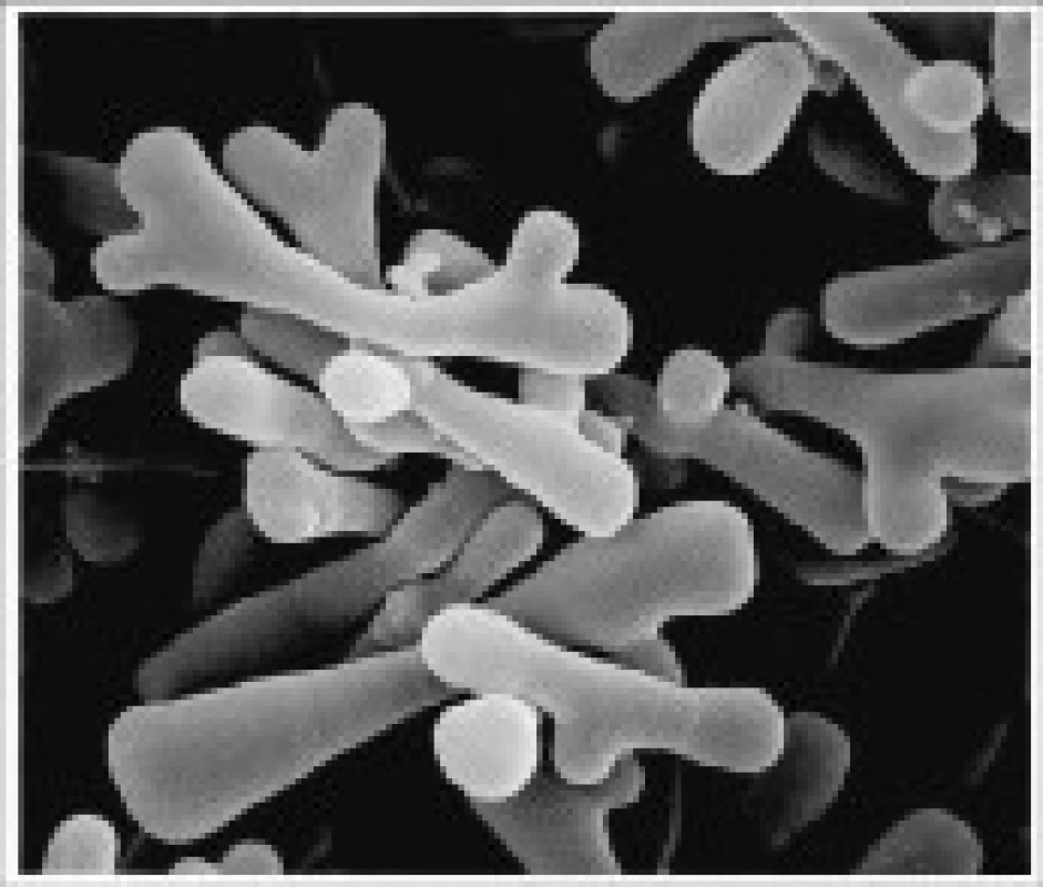 Bifidobacterium species – mikroskopie. 
Internetový zdroj: &lt;a href=&quot;http://oncologiaesalute.files. worldpress.com&quot;&gt;http://oncologiaesalute.files. worldpress.com&lt;/a&gt;
