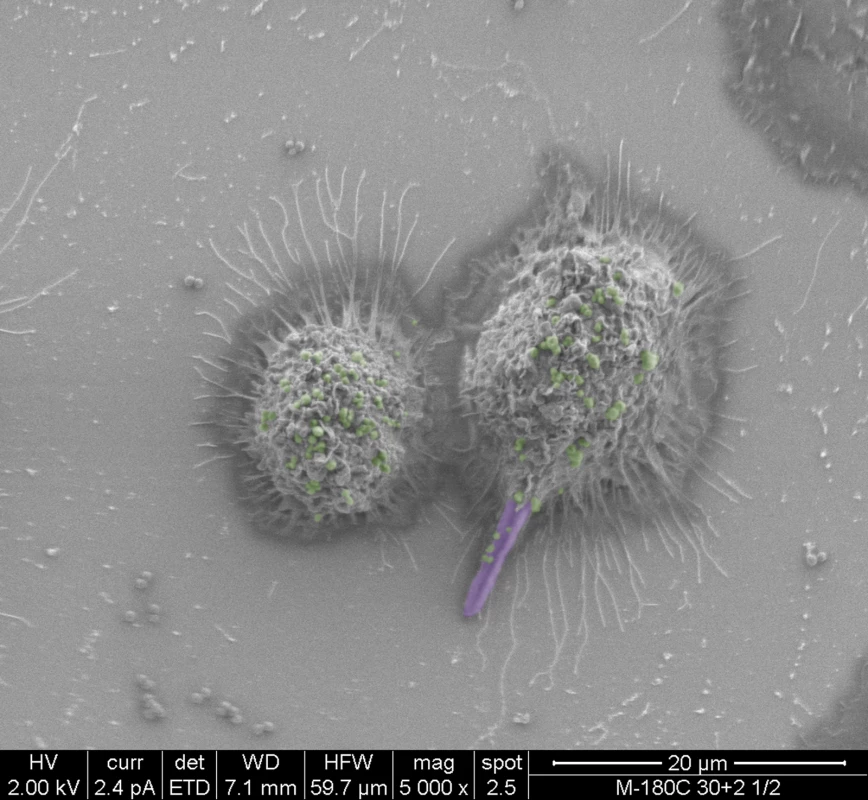 False-colored scanning electron micrographs depicting the co-phagocytosis of <i>C</i>. <i>albicans</i> and <i>S</i>. <i>aureus</i> by murine macrophages.