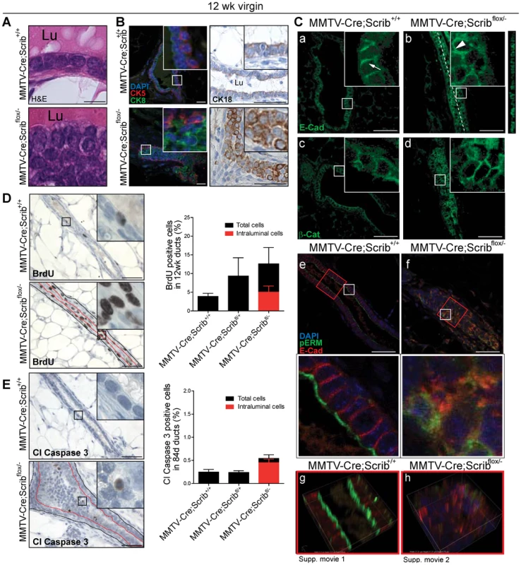 <i>Scrib</i>-deficient lesions are characterized by polarity loss and the expansion of rapidly cycling poorly differentiated luminal mammary epithelial cells.