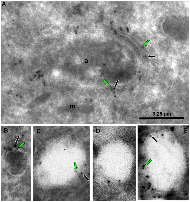 Electron-lucent vesicles accumulate upon ddFYVE expression and contain apicoplast peripheral membrane proteins and PI3P.