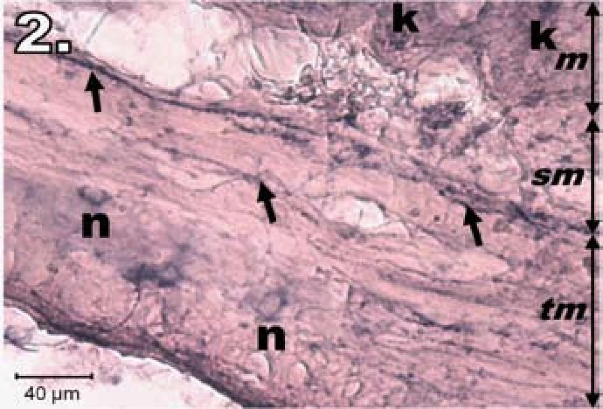 Histologický obraz jejuna v skupine R1. n – poškodené NADPH-d pozitívne neuróny slabo ofarbené, šípky – nervové vlákna slabo ofarbené, k – Lieberkühnove krypty negatívne, m – mukóza, sm – submukóza, tm – tunica muscularis; scale bar = 40 μm
Fig. 2. Histological picture of jejunum in group R1. n – damaged lightly stained NADPH-d positive neurons, arrows – lightly stained nerve fibres, k – negativity in Lieberkühn's crypts, m – mucosa, sm – submucosal layer, tm – tunica muscularis; scale bar = 40 μm