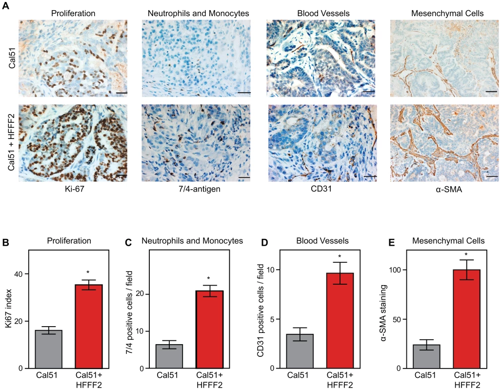 Tumor-supportive fibroblasts have profound effects on the composition of the tumor microenvironment.