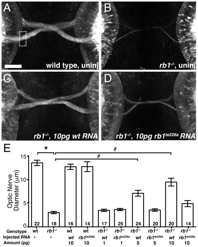 <i>rb1</i> mRNA overexpression rescues optic nerve hypoplasia in <i>rb1<sup>te226</sup></i> mutants.