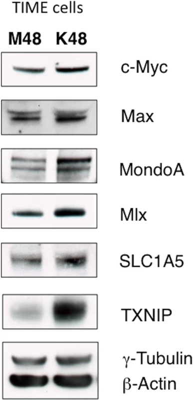 KSHV infection of endothelial cells increases protein expression of the Myc/MondoA network and downstream targets, including the glutamine transporter SLC1A5.