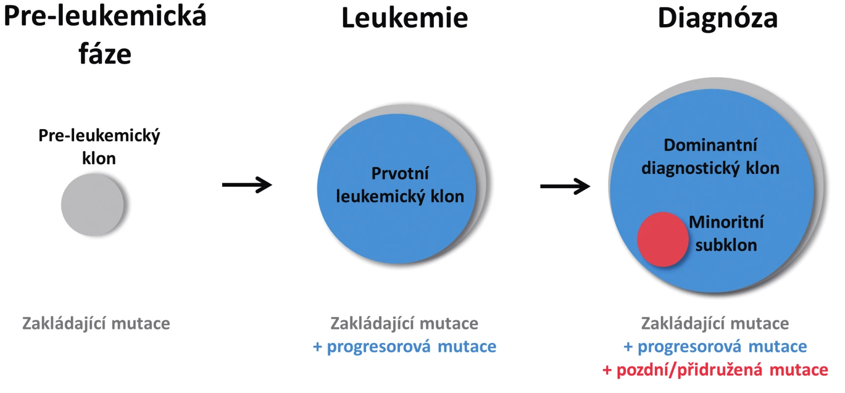 Zjednodušené schéma vícekrokového postupného vývoje AML
Z hematopoetického klonu nesoucího zakládající mutaci vzniká po získání druhé, progresorové mutace klon s plně leukemogenní kapacitou. Po výskytu další mutace u jedné z leukemických buněk vzniká subklon, který v době diagnózy představuje pouze minoritní část leukemických buněk. Velikost kruhů vyjadřuje poměrné zastoupení jednotlivých mutací.