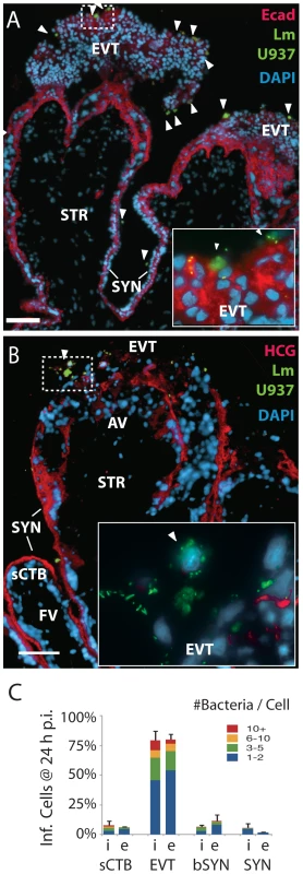 <i>L. monocytogenes</i> infects anchoring villi by cell-to-cell spread.