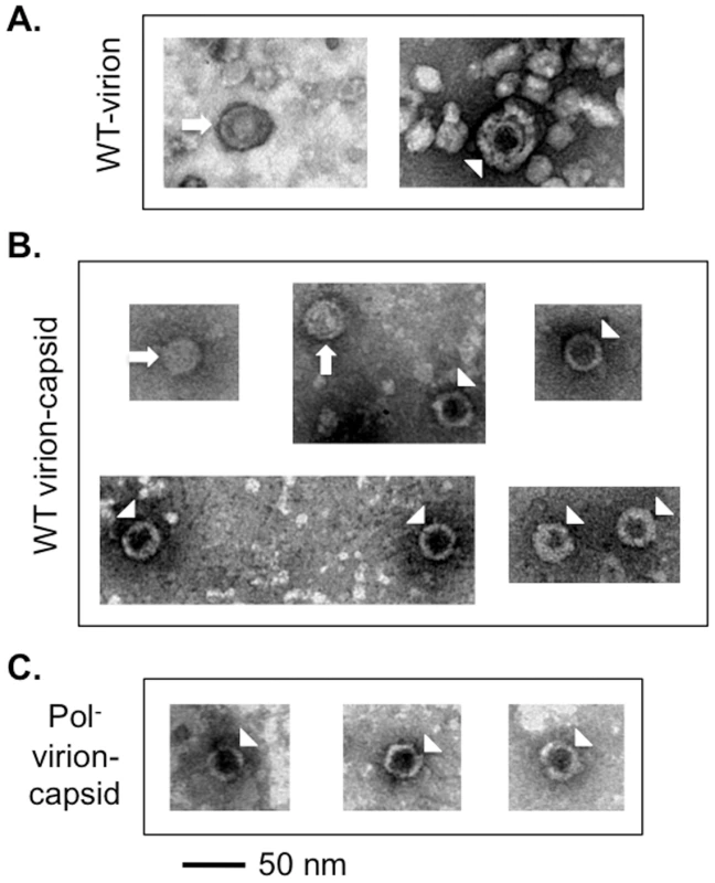 EM of HBV virions and virion-derived capsids.