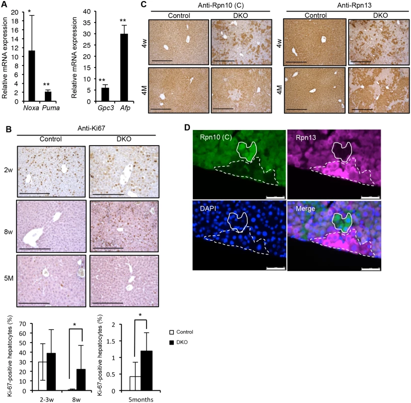 Spontaneous liver injury, fibrosis and regeneration in DKO mice.