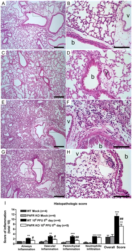 Histological changes after Influenza A WSN/33 H1N1 lethal infection in WT and PAFR deficient mice.