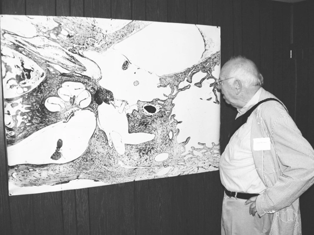 Prof. Leslie Michaels v domě prof. Schuknechta; na stěně foto histologie spánkové kosti s otosklerózou po stapedektomii.