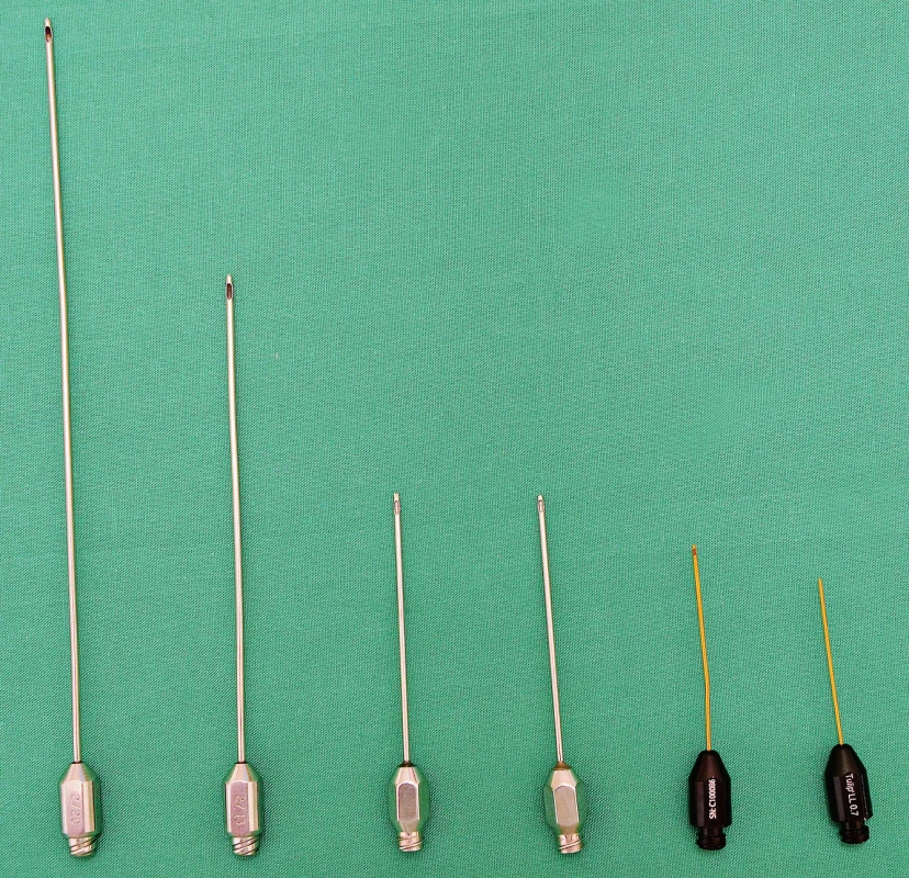 Application cannulas. On the left, 2mm cannulas with a length of 20 and 13 cm (PLA188 and 189 models, Pouret Medical, France). In the centre, 1.5mm cannulas with a blunt tip (Coleman™ Style 1, Mentor, USA) and “V” shaped tip to release scars (“V” Dissector Cannulae, Mentor, USA). These cannulas and similar styles are suitable for lipomodelling of the breast. On the right is an example of cannulas for fat grafting to the face, diameter 0.9 and 0.7 ml (Tulip, USA)