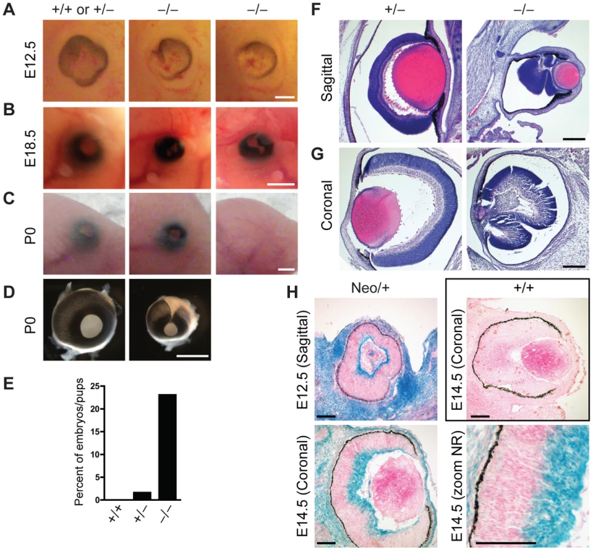 Defects in eye development in Jarid1b knockout embryos.