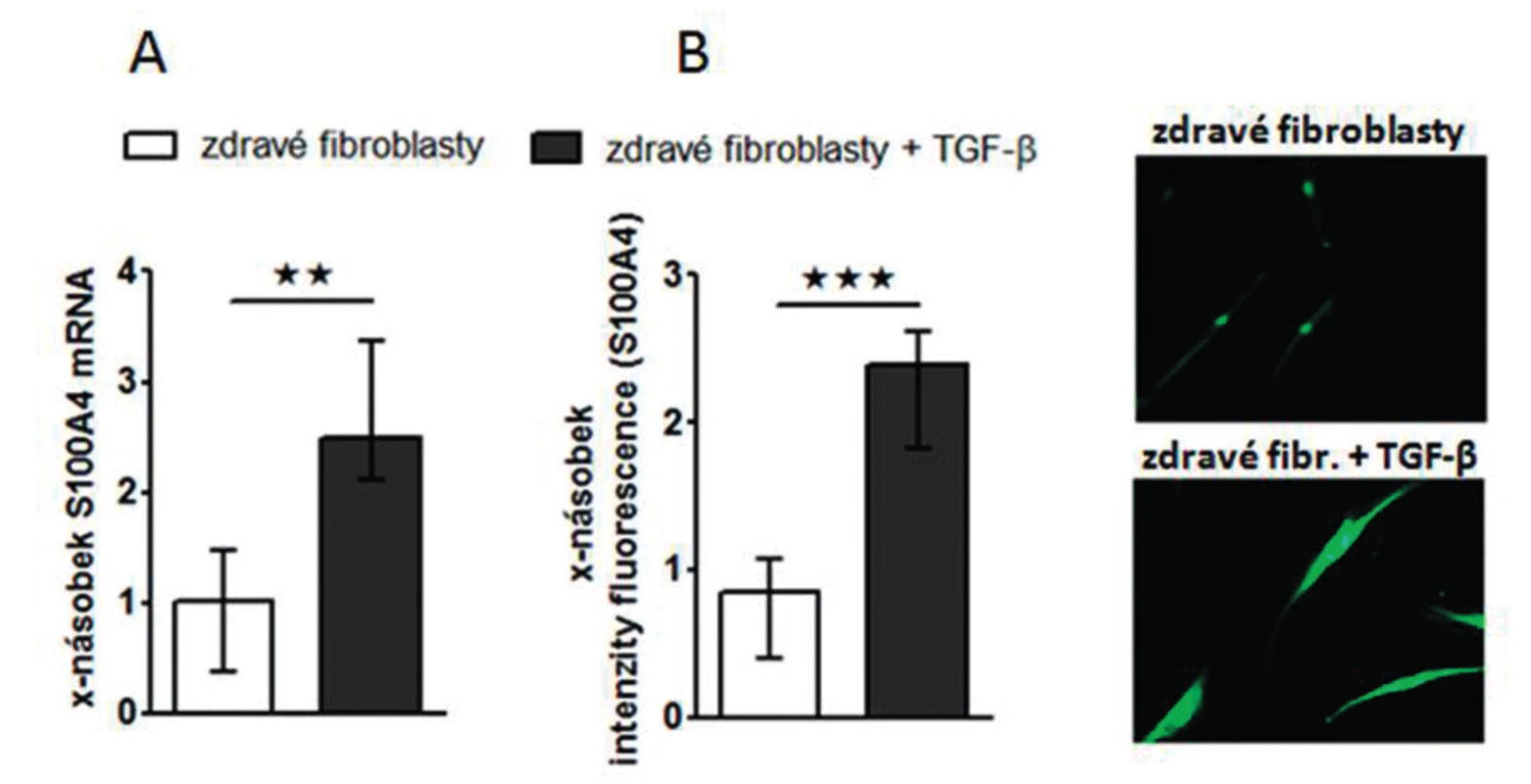 Exprese S100A4 je zvýšená ve zdravých fibroblastech stimulovaných TGF-ß