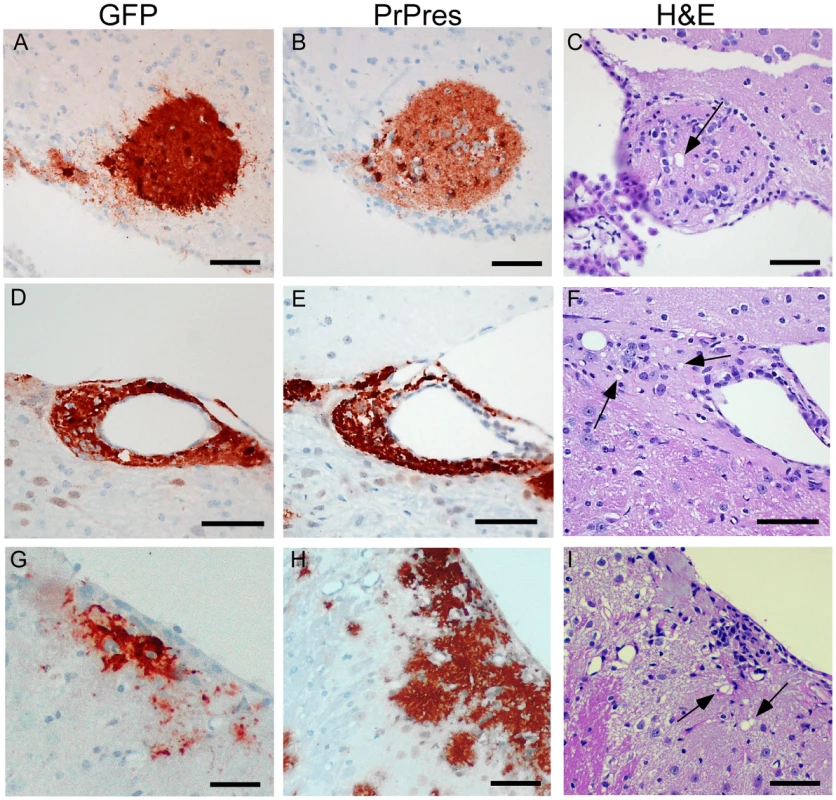 Detection of PrPres and vacuolation in brain tissue of PrPnull and tg44+/− mice with C57BL/6 brain grafts.