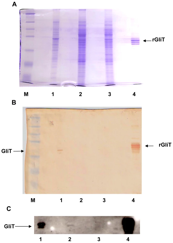 Immunoaffinity purified human IgG detects native GliT in <i>A. fumigatus</i>.