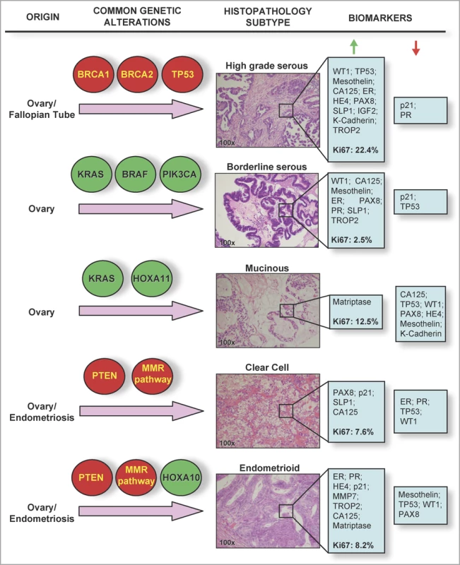 Histological and Molecular Heterogeneity in Epithelial Ovarian Cancers